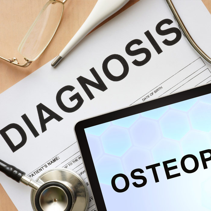 Osteoporosis Rehabilitation Treatment & Physiotherapy